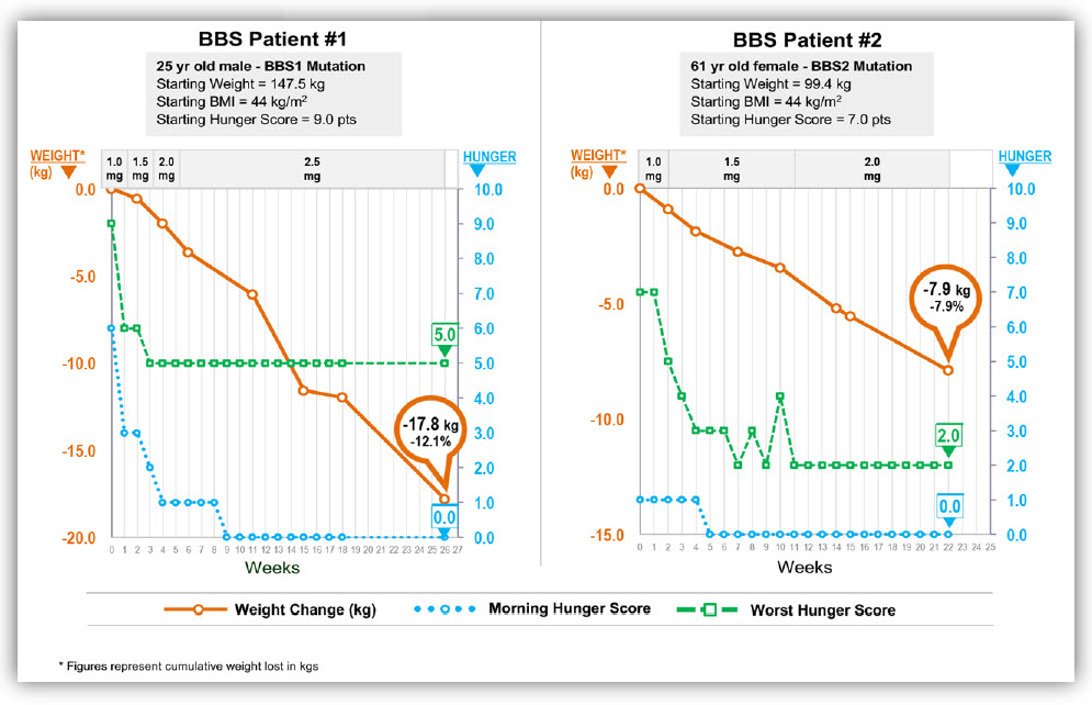 Weight loss figure for 25 year old male BBS patient and 61 year old BBS patient