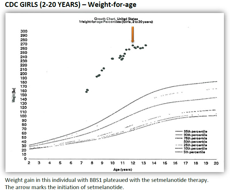 CDC weight-for-age figure displaying information for females age 2 to 20
